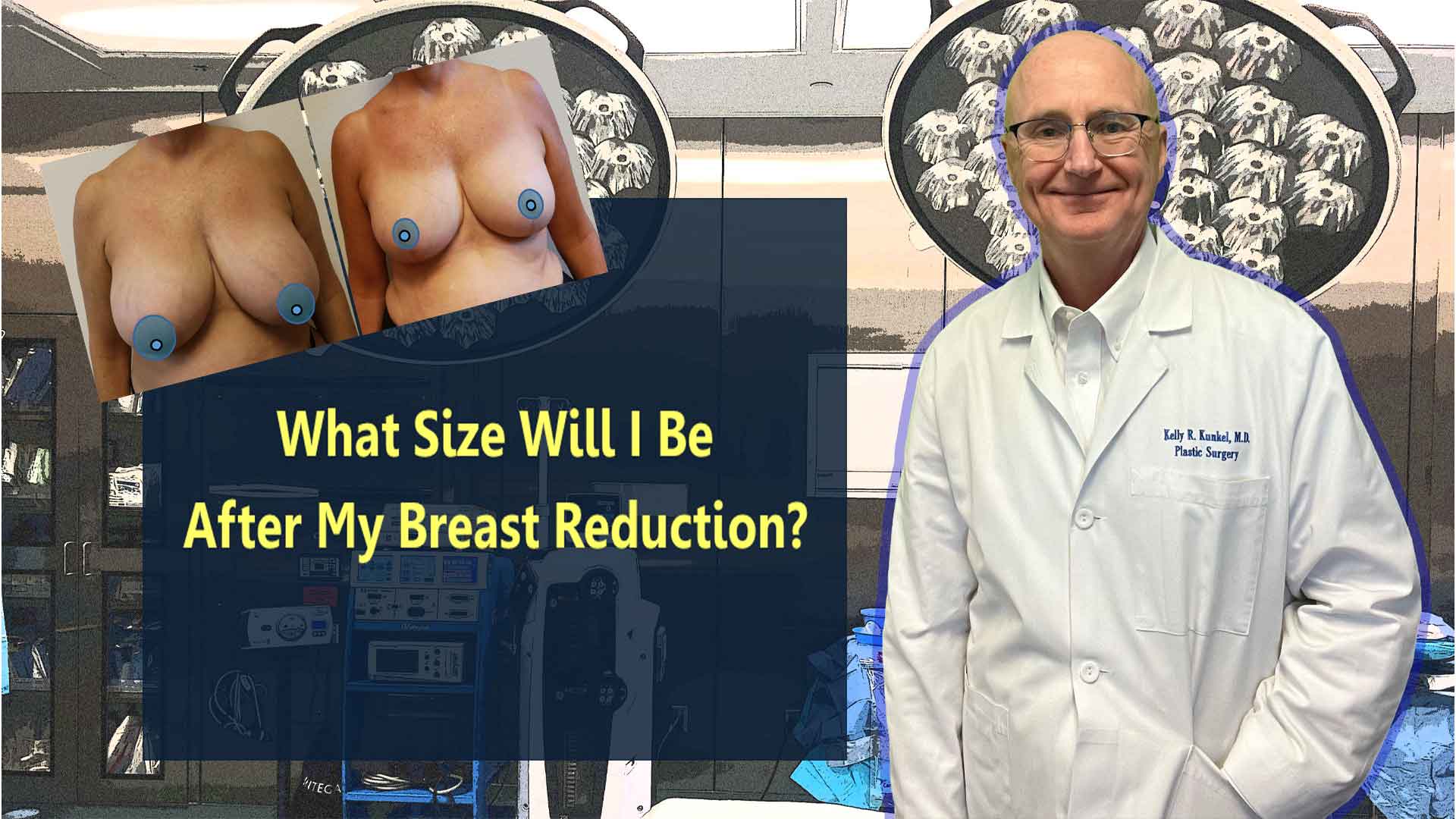 MY BREAST REDUCTION SURGERY VLOG!